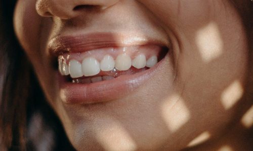Tre ting du bør overveje når du vælger tandtekniker